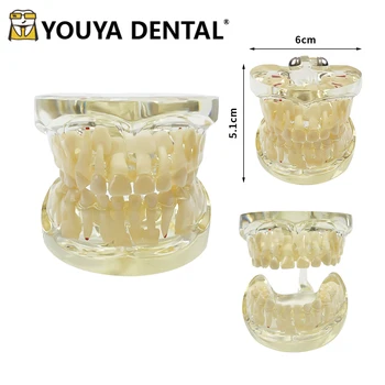 Стоматологичен модел детски патологични на млечните зъби Модел на млечен зъб за обучение по стоматология Инструменти за комуникация лекар-пациент
